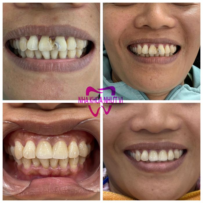 Hình ảnh NHA KHOA NHỰT VI 2