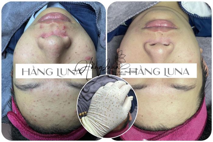 Hình ảnh 1 của Hằng Luna Spa