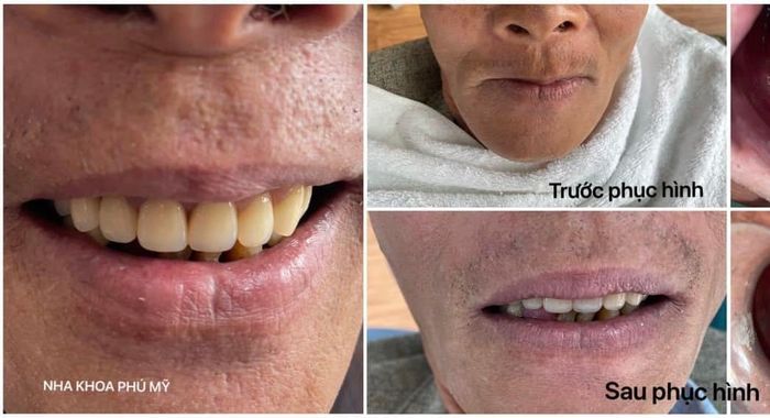 Hình ảnh Nha khoa Phú Mỹ 1