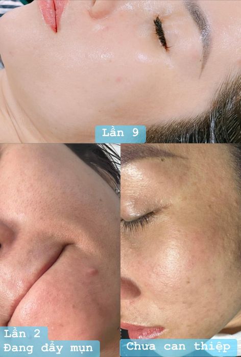 Hình ảnh đầu tiên của Tấm Spa