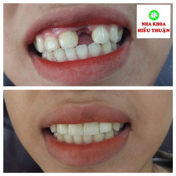 Hình ảnh của Nha Khoa Hiếu Thuận 2
