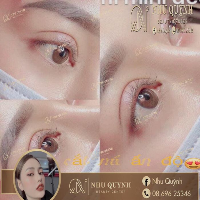 Hình ảnh Như Quỳnh Beauty Center 1