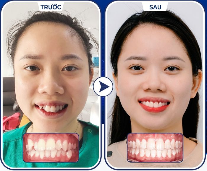 Hình ảnh Nha Khoa Pháp Việt 2