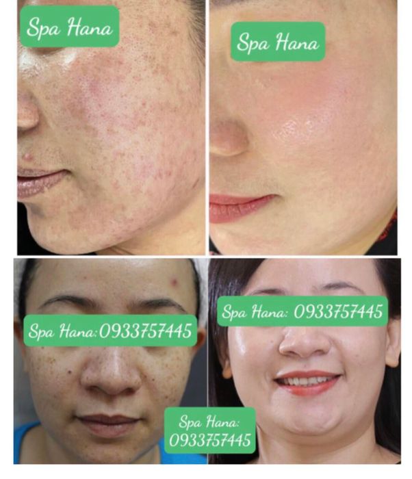 Hình ảnh Spa Hana 1