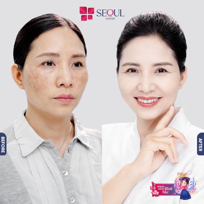 Hình ảnh của Thẩm Mỹ Viện Seoul Center 2