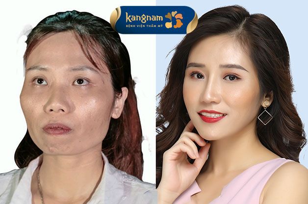 Ảnh 2 của Viện Thẩm Mỹ Kangnam Bình Dương