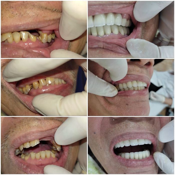 Nha Khoa Nụ Cười Mới hình 2