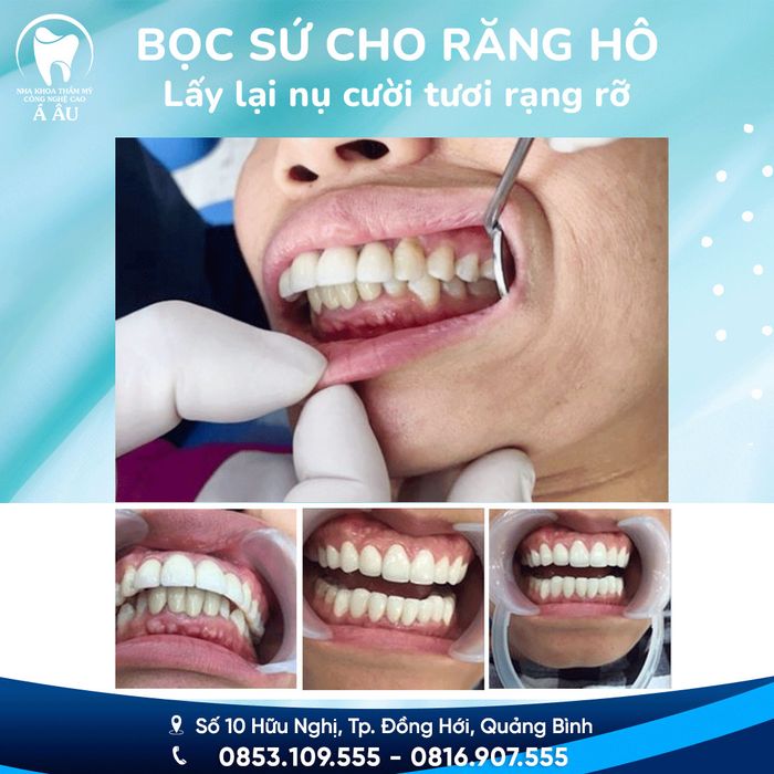 Hình ảnh Nha khoa Á Âu Đồng Hới 1