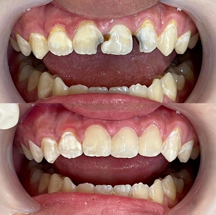 Hình ảnh Nha Khoa Lan Thanh 2