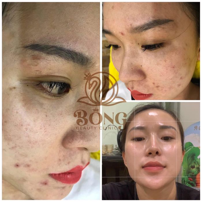 Hình ảnh Bông Spa - Healthy & Beauty 2