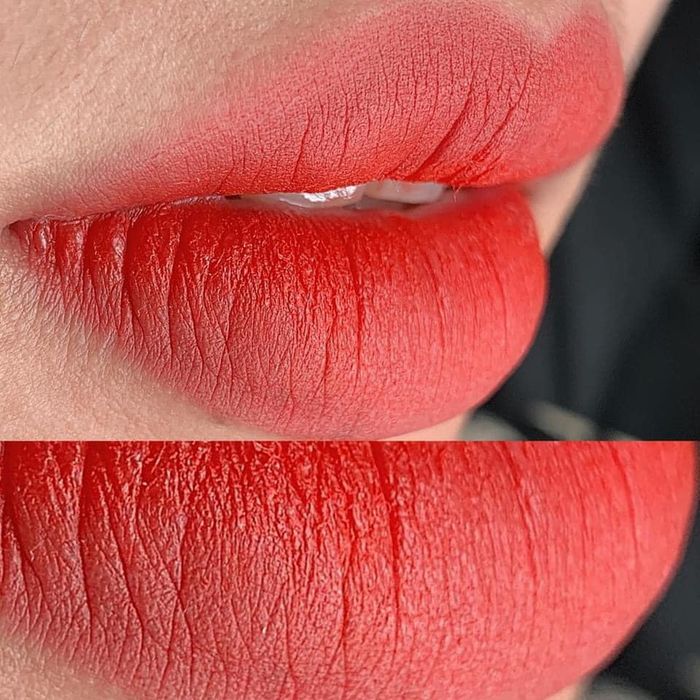 Hình ảnh 2 của Thẩm Mỹ Viện Quốc Tế VENUS