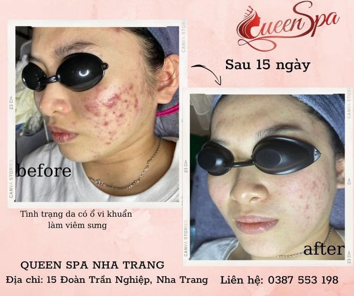 Hình ảnh 2 của Queen Spa Nha Trang
