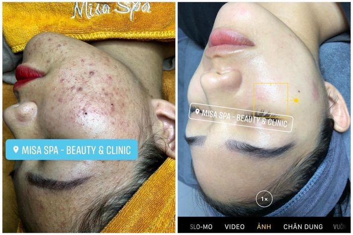 Ảnh MiSa Spa - Beauty & Clinic 1