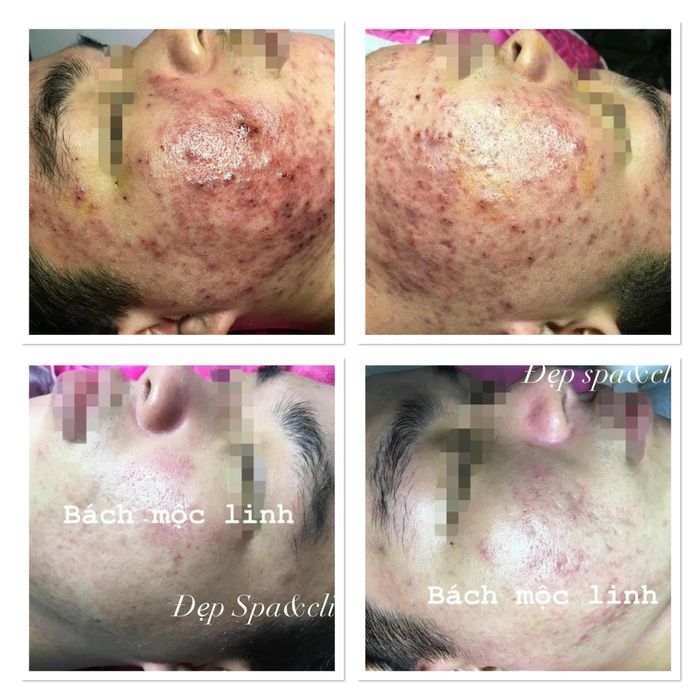 Hình ảnh số 1 tại Đẹp Spa & Clinic