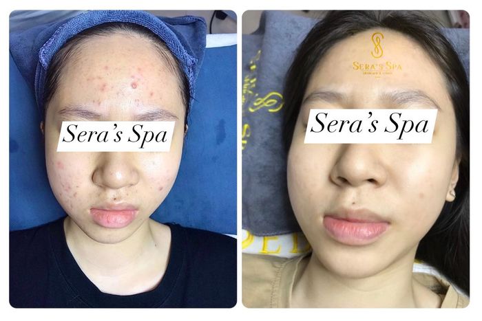 Hình ảnh số 1 tại Sera’s Spa & Clinic