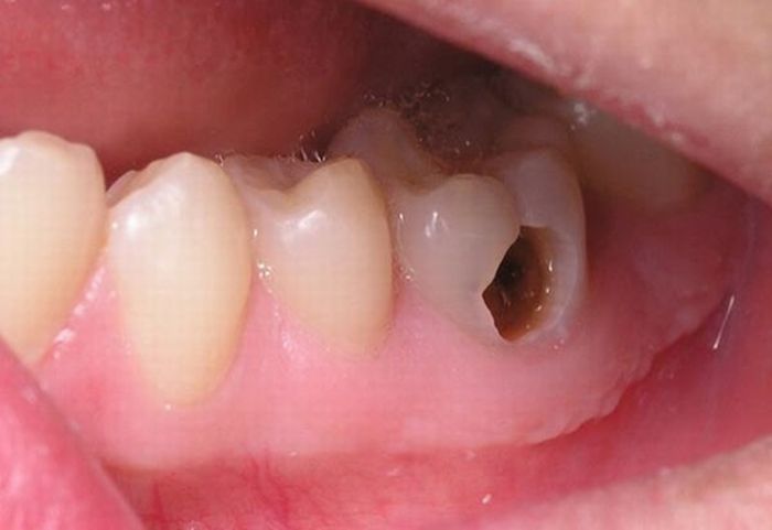 Hình ảnh 3 của Nha Khoa Nụ Cười