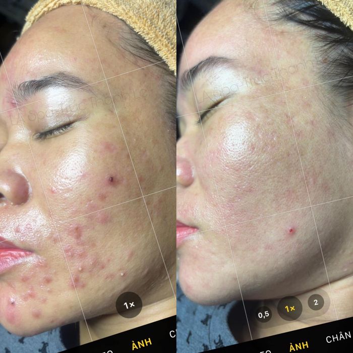 Hình ảnh La Spa & Skincare 1