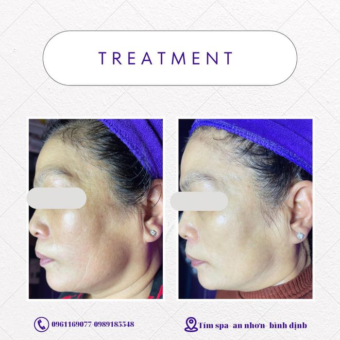 Hình ảnh Tím Spa An Nhơn 1