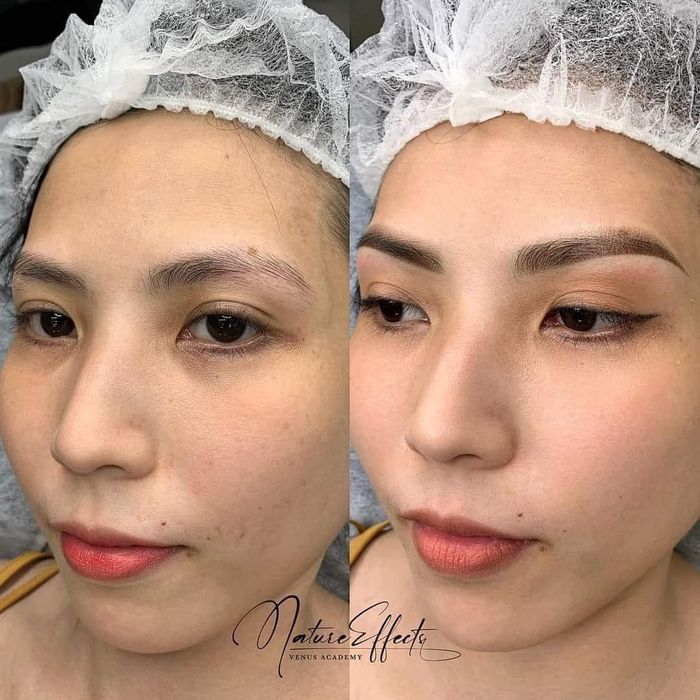 Hình ảnh 1 của Thẩm Mỹ Viện Quốc Tế VENUS