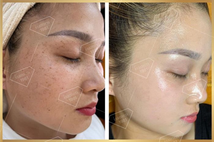 Hình ảnh Vy Beauty Spa 1