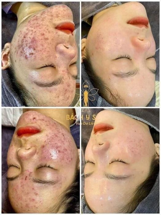 Hình ảnh Thẩm Mỹ Viện Sang Moon 2