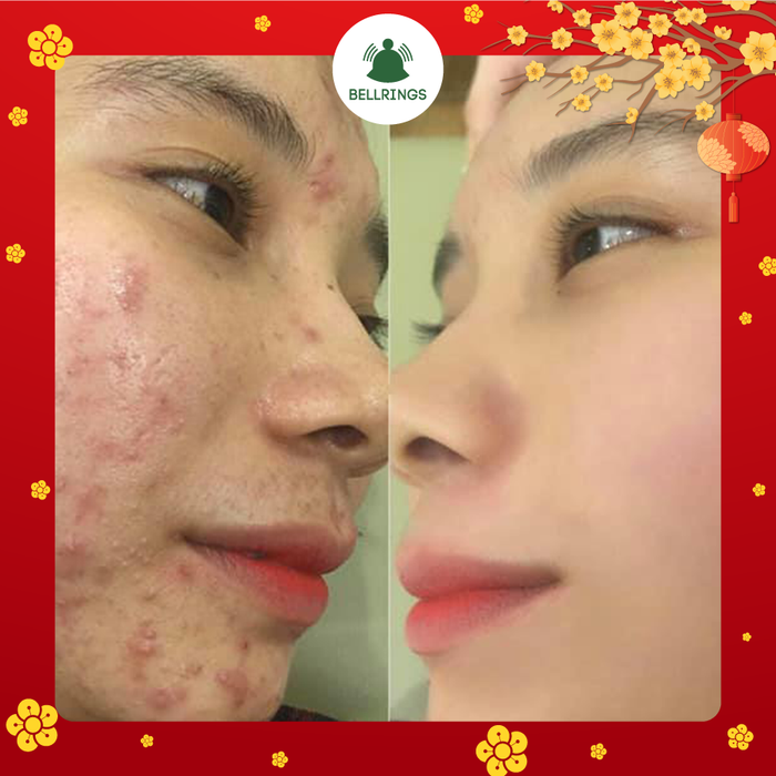 Hình ảnh Bellrings Thái Bình số 2