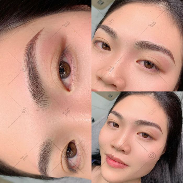 Thẩm Mỹ Bảo Hân hình 2