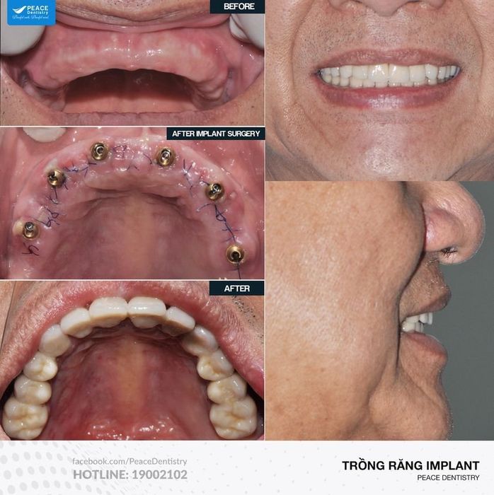 Hình ảnh tại phòng khám nha khoa Peace Dentistry