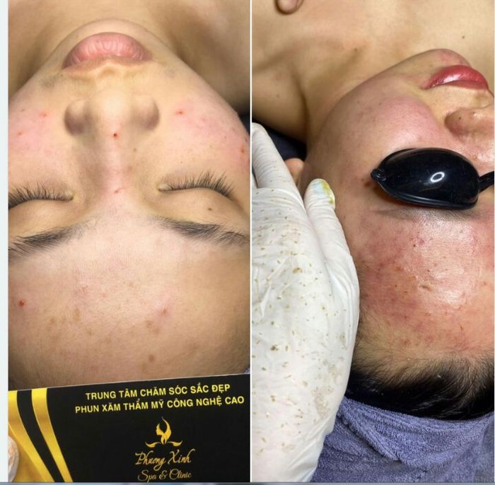 Hình ảnh Phương Xinh Spa 1