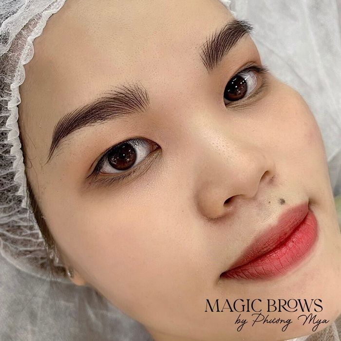 Hình ảnh 2 của Thẩm Mỹ Quốc Tế Phương Mya