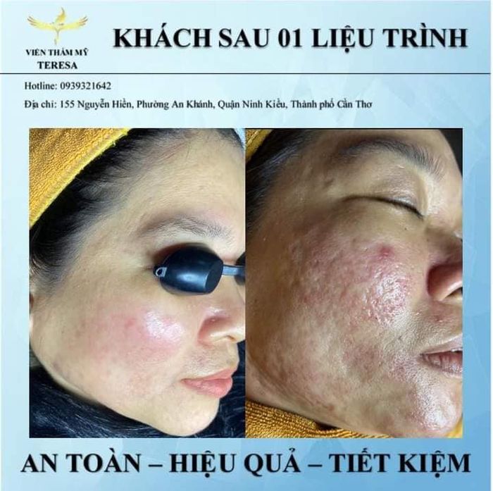 Viện Thẩm Mỹ Te Re Sa ảnh 1