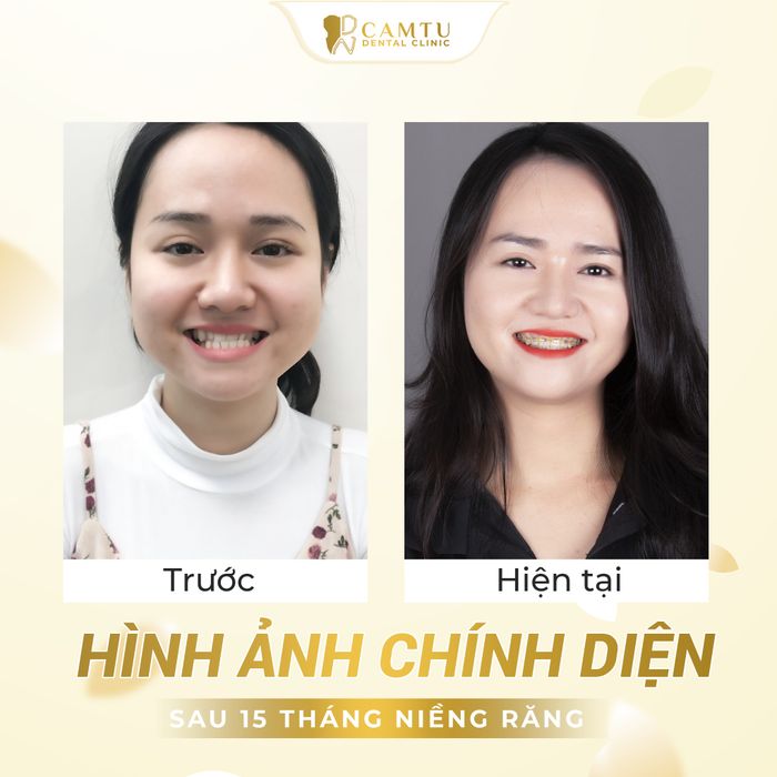 Hình ảnh Nha Khoa Cẩm Tú 3