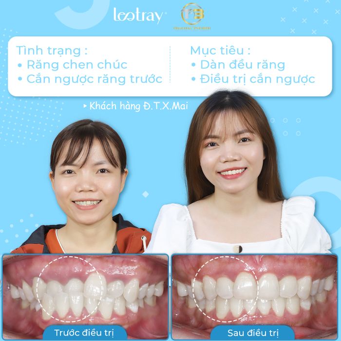 NHA KHOA TRẦN BÌNH hình 1