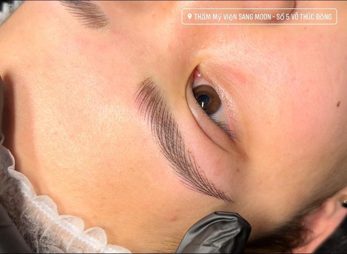 Hình ảnh Thẩm Mỹ Viện Sang Moon 2