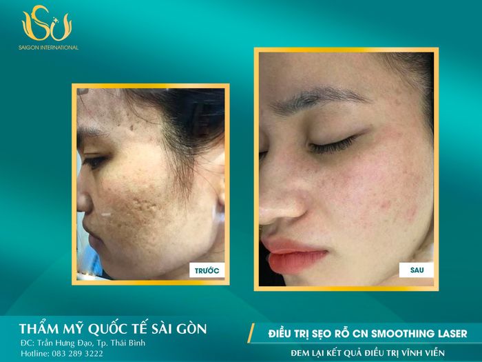 Hình ảnh Thẩm Mỹ Quốc Tế Sài Gòn số 1