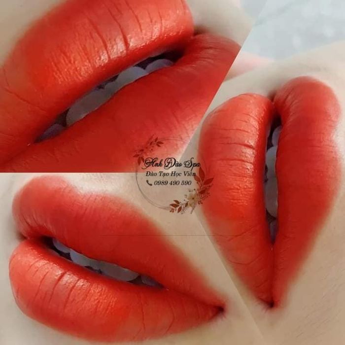 Hình ảnh Thẩm Mỹ Anh Đào