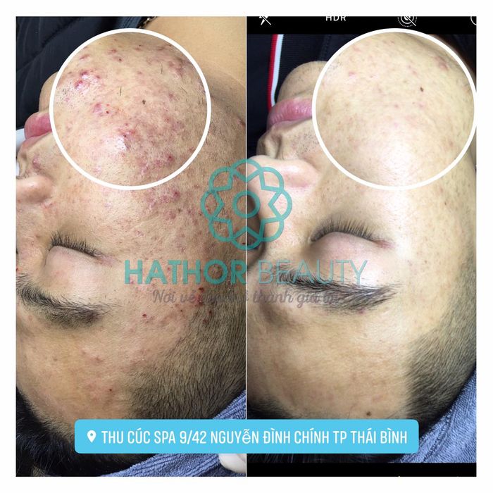 Thu Cúc Spa - Hình ảnh 1