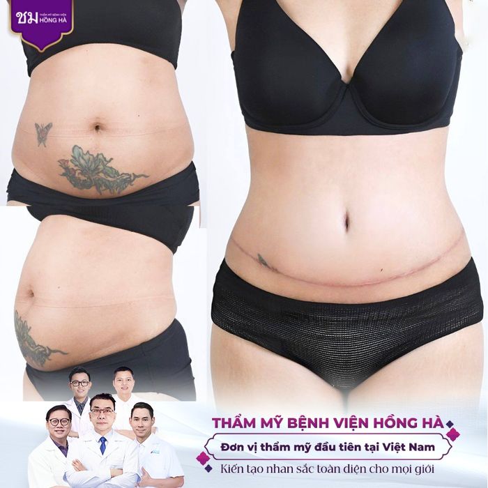 Hình ảnh Thẩm mỹ viện Hồng Hà 2