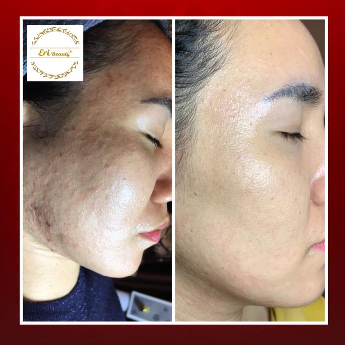 Hình ảnh ERI Beauty Center số 2