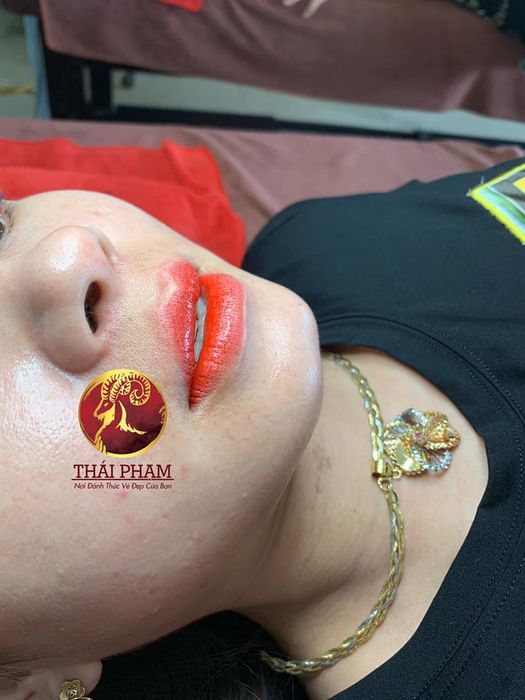 Hình ảnh sản phẩm tại thẩm mỹ Thái Phạm 2