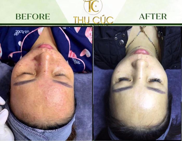 Thu Cúc Spa - Hình ảnh 2