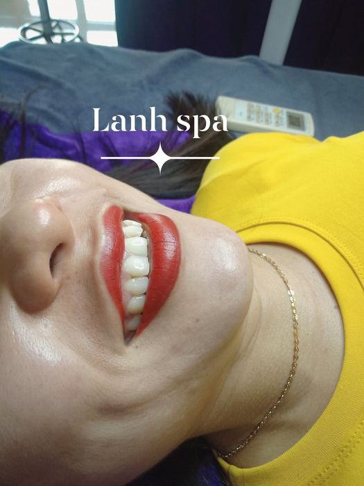 Hình ảnh 2 tại Lanh Spa