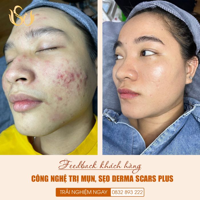 Hình ảnh Thẩm Mỹ Quốc Tế Sài Gòn số 2