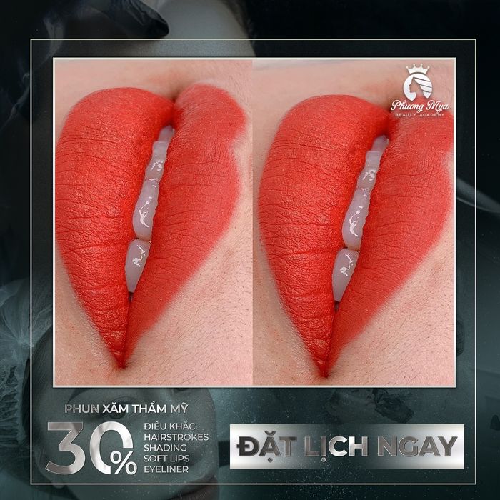 Hình ảnh 3 của Thẩm Mỹ Quốc Tế Phương Mya