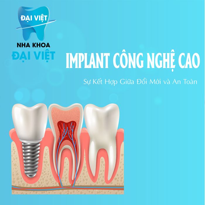 Hình ảnh 2 của Nha Khoa Đại Việt