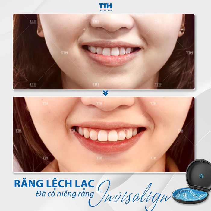 Bệnh viện Thái Thượng Hoàng hình ảnh 3