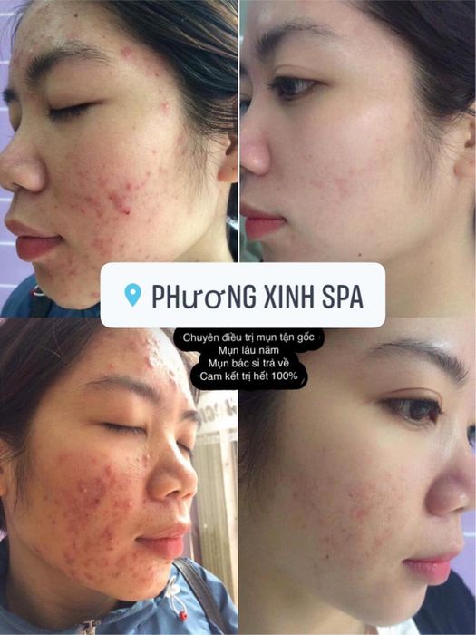 Hình ảnh Phương Xinh Spa số 2