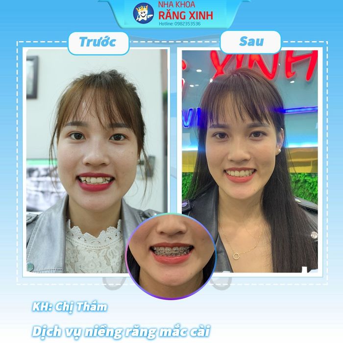 Nha khoa Răng Xinh hình ảnh 2