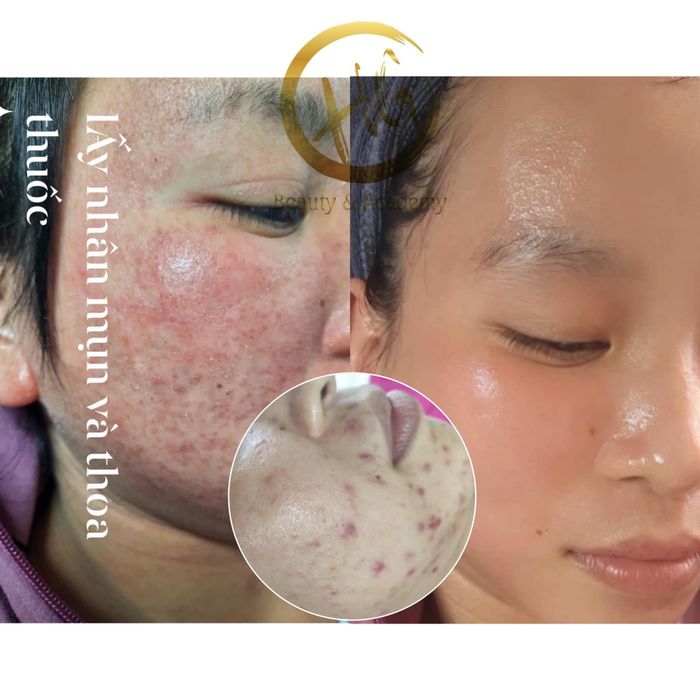 Hình ảnh Huỳnh Giao Skincare & Beauty 2