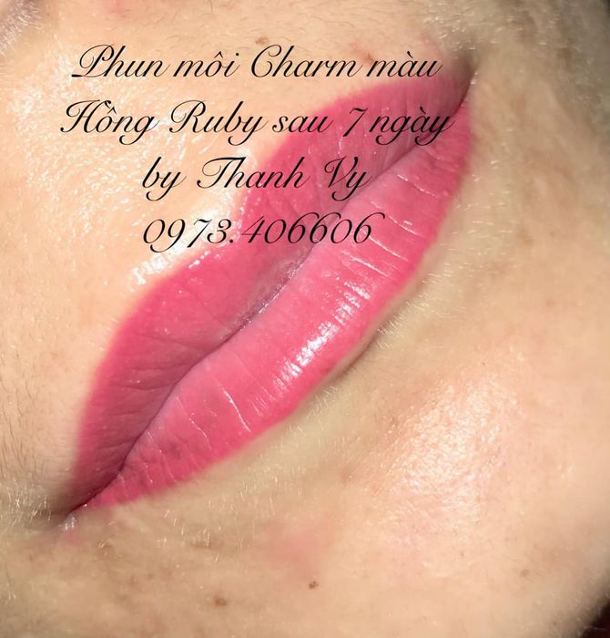 Thẩm Mỹ Thanh Vy hình ảnh 2